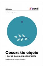 Cesarskie cięcie i poród po cięciu cesarskim