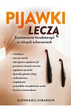 Pijawki leczą