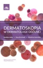 Dermatoskopia w dermatologii ogólnej