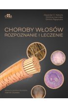 Choroby włosów. Rozpoznanie i leczenie