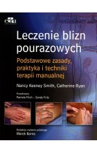Leczenie blizn pourazowych