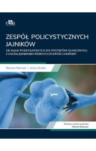Zespół policystycznych jajników