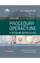 Procedury operacyjne w ortopedii pediatrycznej. Tachdjian