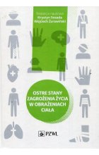 Ostre stany zagrożenia życia w obrażeniach ciała