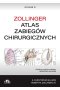 Atlas zabiegów chirurgicznych. Zollinger