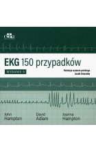 EKG 150 przypadków