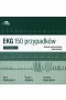 EKG 150 przypadków