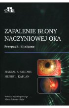 Zapalenie błony naczyniowej oka