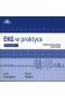 Ekg w praktyce