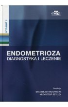 Endometrioza Diagnostyka i leczenie