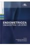 Endometrioza Diagnostyka i leczenie