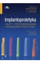 Implantoprotetyka Zalety przeciwwskazania rozwiązania praktyczne