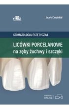 Licówki porcelanowe na zęby żuchwy i szczęki