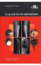 Zakażenia w ortopedii