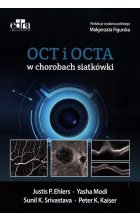 OCT i OCTA w chorobach siatkówki