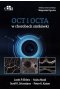 OCT i OCTA w chorobach siatkówki