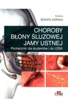 Choroby błony śluzowej jamy ustnej