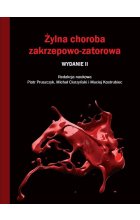 Żylna choroba zakrzepowo-zatorowa