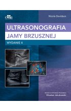 Ultrasonografia jamy brzusznej