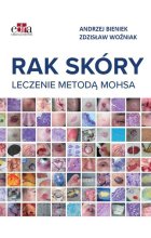 Rak skóry Leczenie metodą Mohsa