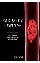 Zakrzepy i zatory