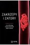 Zakrzepy i zatory