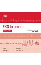 EKG to proste