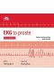EKG to proste