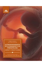 Ultrasonografia 3D w diagnostyce prenatalnej