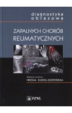 Diagnostyka obrazowa zapalnych chorób reumatycznych