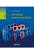 Od bondingu do implantoprotetyki. Cz. I