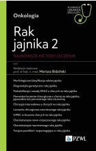 Rak jajnika 2. Najnowsze metody leczenia