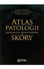 Atlas patologii złośliwych nowotworów skóry