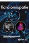 Kardiomiopatie