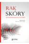 Rak skóry
