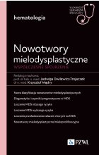 Nowotwory mielodysplastyczne. Współczesne spojrzenie