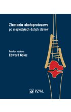 Złamania okołoprotezowe po aloplastykach dużych stawów