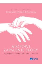 Atopowe zapalenie skóry. Podejście interdyscyplinarne
