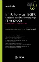 Inhibitory osi EGFR w leczeniu nie drobnokomórkowego raka płuca. W gabinecie lekarza specjalisty.