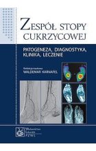 Zespół stopy cukrzycowej