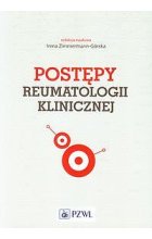 Postępy reumatologii klinicznej