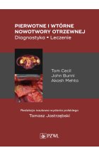 Pierwotne i wtórne nowotwory otrzewnej