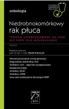 Niedrobnokomórkowy rak płuca. W gabinecie lekarza specjalisty.