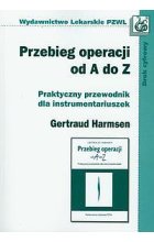 Przebieg operacji od A do Z