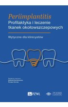 Periimplantitis. Profilaktyka i leczenie tkanek okołowszczepowych