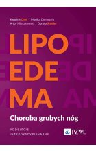 Lipoedema