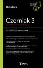 Czerniak 3. Współczesne podejście.