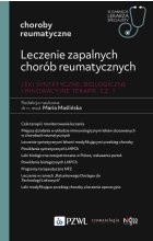 Leczenie zapalnych chorób reumatycznych. Leki syntetyczne, biologiczne i innowacyjne terapie. Cz. I