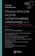 Obrazy kliniczne tocznia rumieniowatego układowego, cz. 2. Na podstawie opisów przypadków