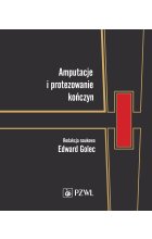 Amputacje i protezowanie kończyn